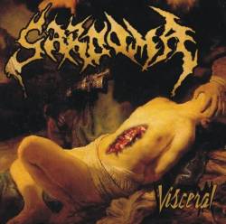 Sarcoma (MEX-2) : Visceral